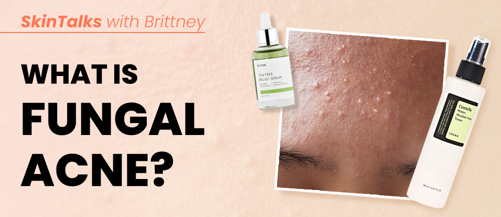 ¿Qué es el acné fúngico? 