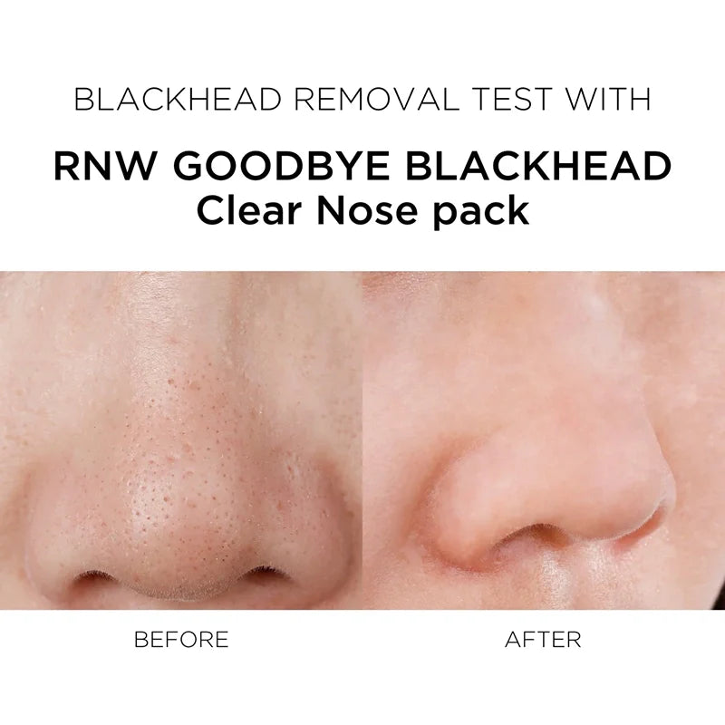 2 STEP Clear Nose Pack